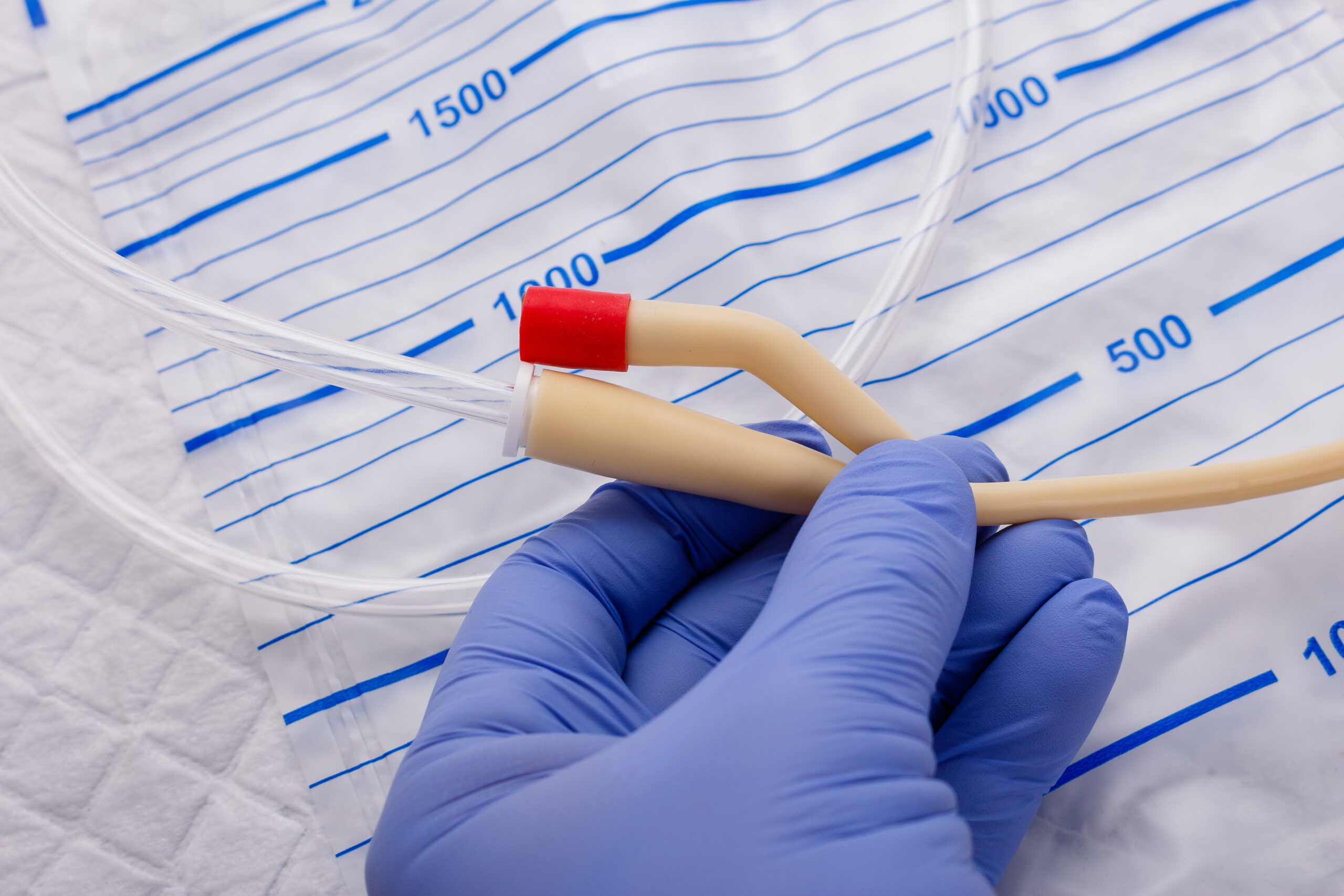nurse inflates urinary catheter bulb with leg drainage bag on sterile field.